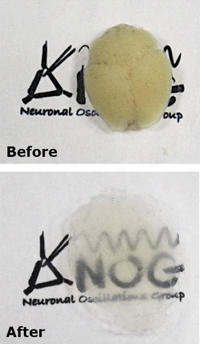 We use cutting edge methods such as CLARITY (pictured) to investigate neural circuitry.